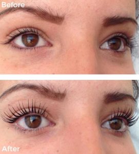 A Before-After Photo of LVL Lashes at VL Aesthetics in Carlisle (Cumbria)
