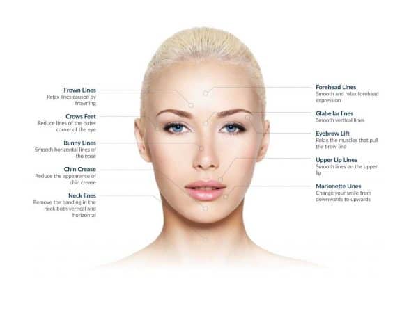 Botox, Juvederm, and other cosmetic injectables at VL Aesthetics